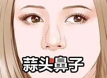 蒜头鼻的女人面相好不好？剖析蒜头鼻在命相学中的影响