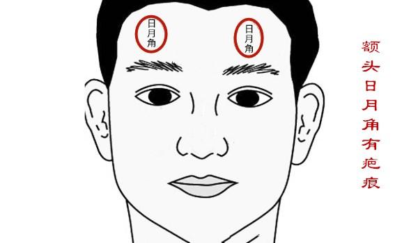 山根处留疤了如何转运？教你通过转运改变命运的方法